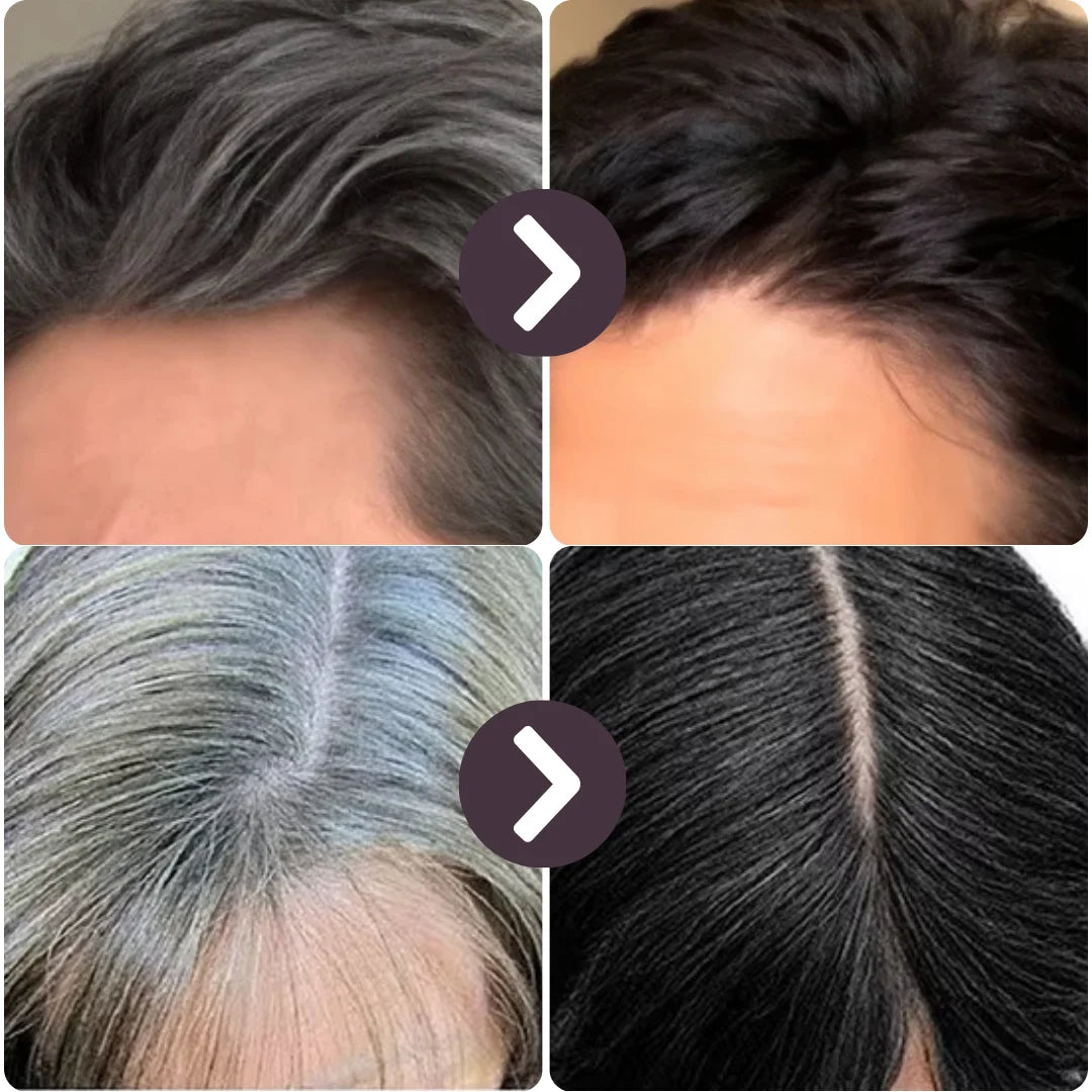 BrimlessHair™ – Shampoo Anticanas 3 en 1