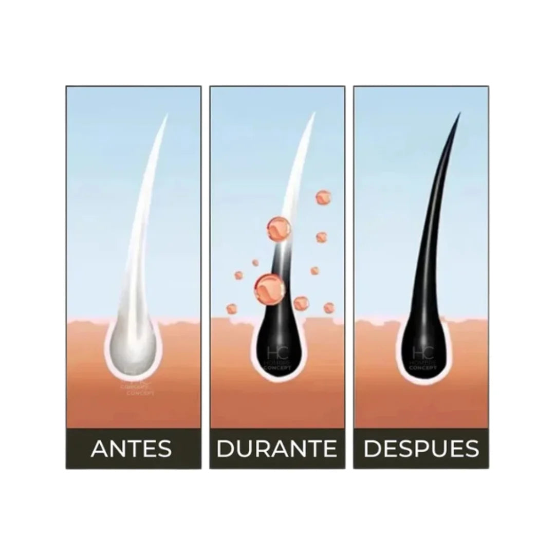 BrimlessHair™ – Shampoo Anticanas 3 en 1